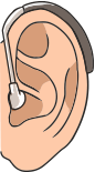 耳かけ型補聴器のイラスト