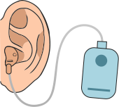 ポケット型補聴器のイラスト