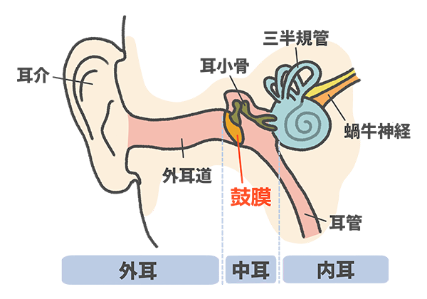 鼓膜穿孔の説明イラスト